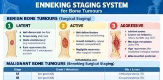 Enneking Staging for Malignant and Benign Bone Tumour