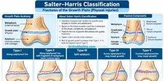 Salter-Harris Fracture related Growth plate anatomy – Make it easy