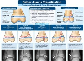 Salter-Harris Fracture related Growth plate anatomy – Make it easy
