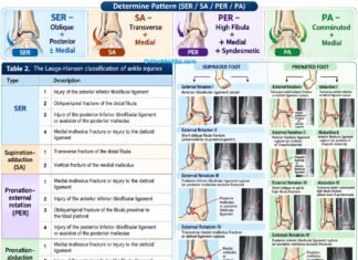 Lauge Hansen Classification for Ankle Fracture (Make it Easy)
